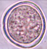 xalapensis